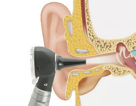 Otoscope illumine l'intérieur d'une oreille jusqu'au tympan